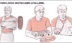Kırık ve Çıkık Durumlarında İlk Yardım Nasıl Yapılmalıdır?
