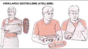 Kırık ve Çıkık Durumlarında İlk Yardım Nasıl Yapılmalıdır?